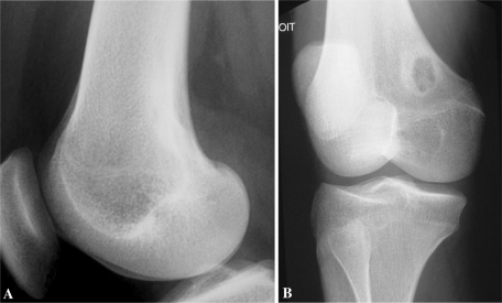 Fig. 1A–B