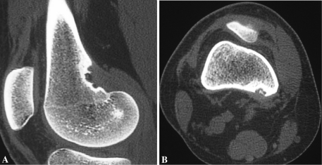 Fig. 4A–B