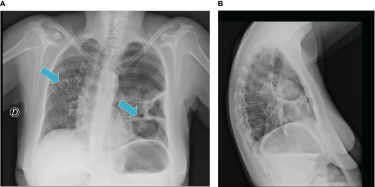 Figure 2