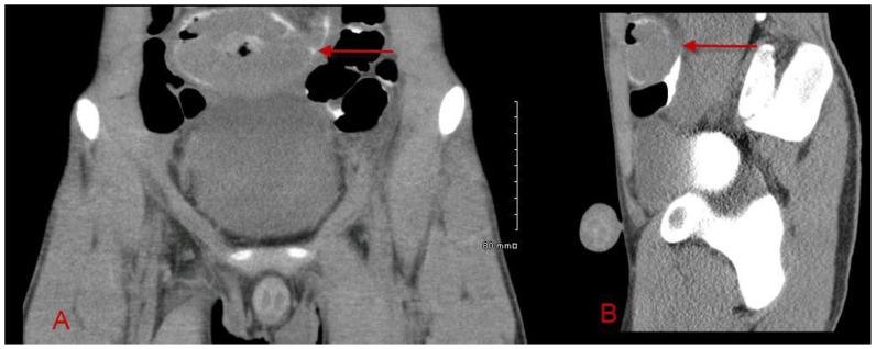 Figure 9