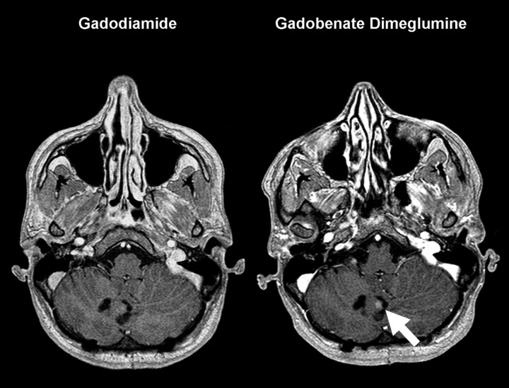 Fig 3.