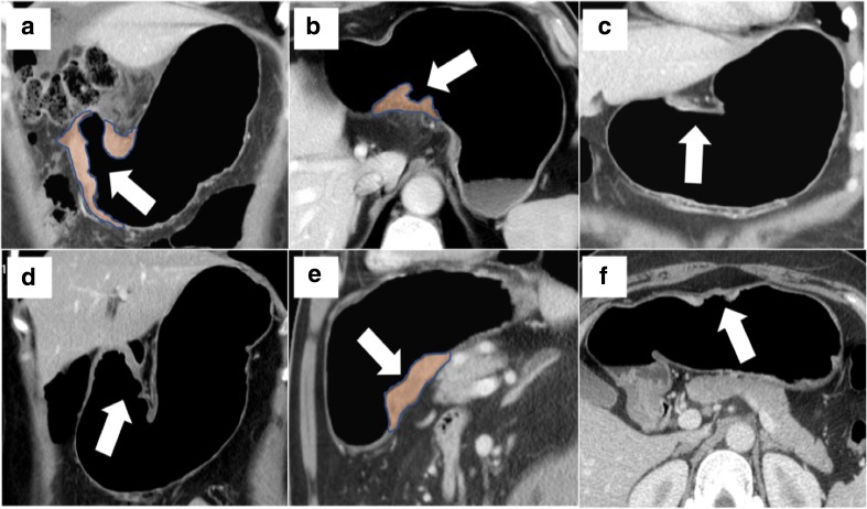 Fig. 6