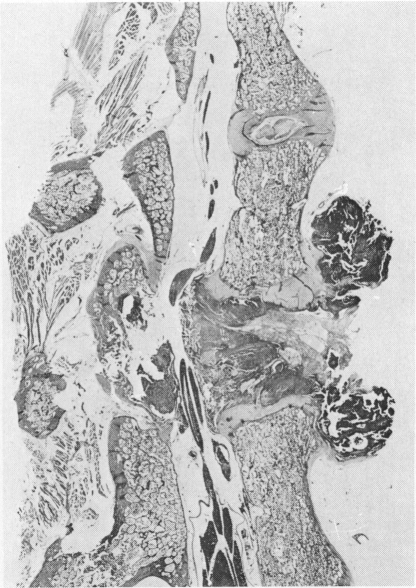 Fig. 19