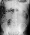 Fig 2