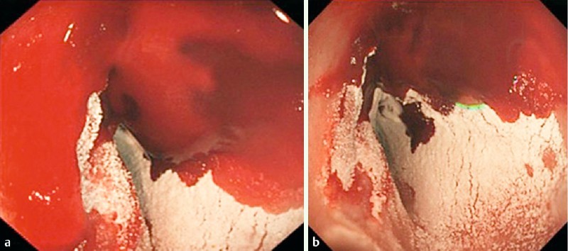 Fig. 2 a, b