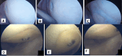 Fig. 11