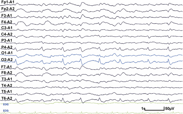 Fig. 2