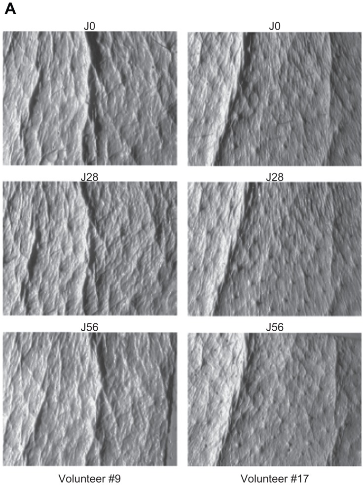 Figure 3A