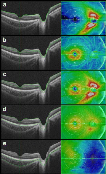 Fig. 1