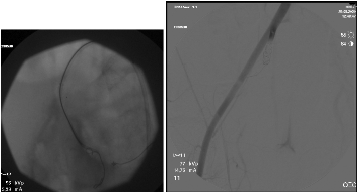 Fig. 4