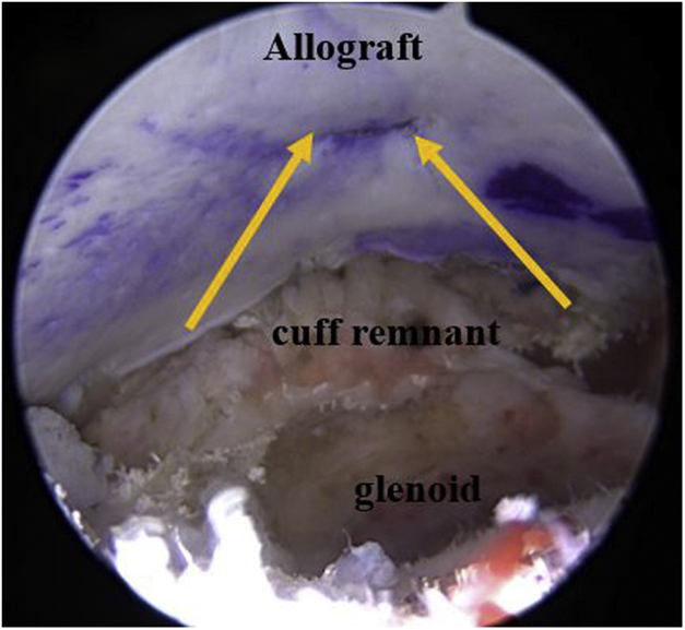 Fig 5