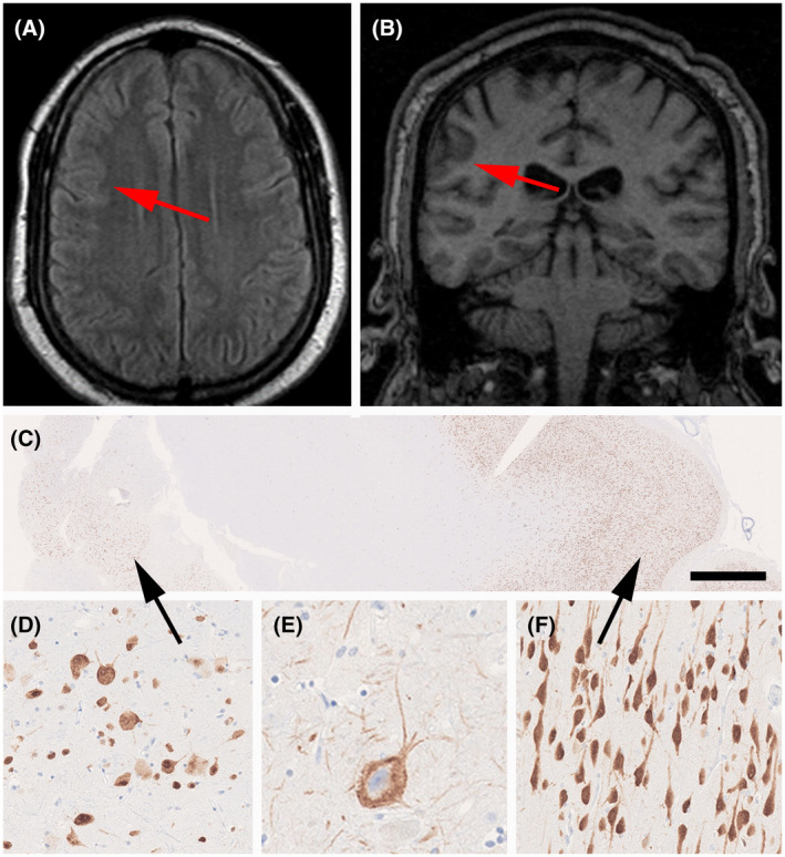 FIGURE 3