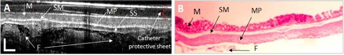 Fig. 13