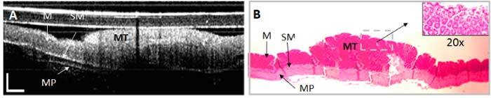 Fig. 14