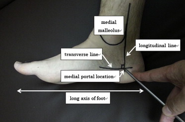 Fig 2