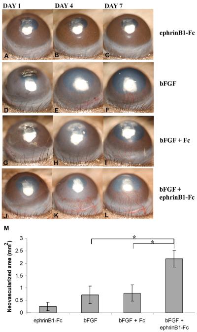 Fig. 16