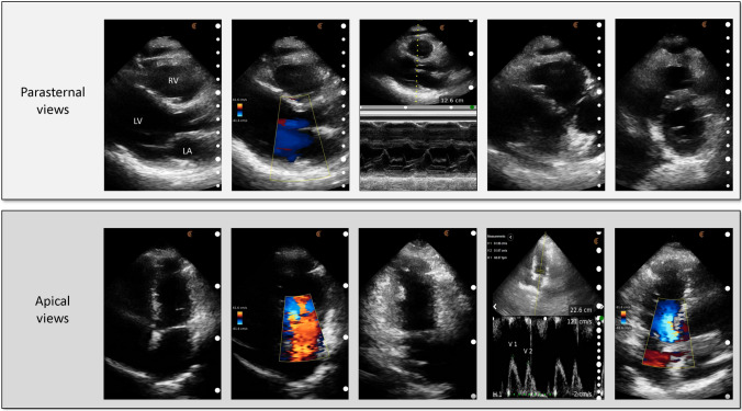 Fig. 2