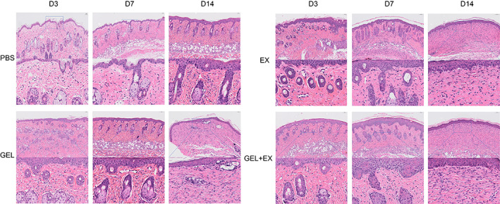 FIGURE 3