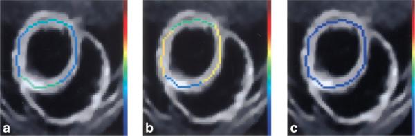 FIG. 6