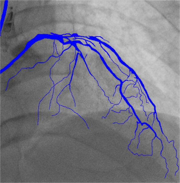 Fig. 4