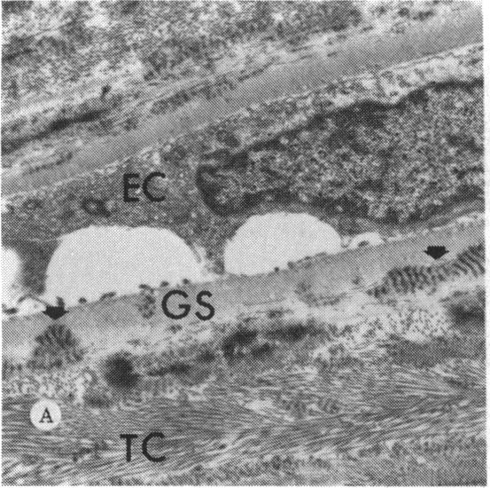 FIGURE 14 A