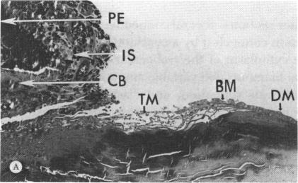 FIGURE 11 A