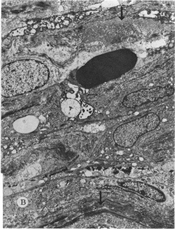 FIGURE 16 B