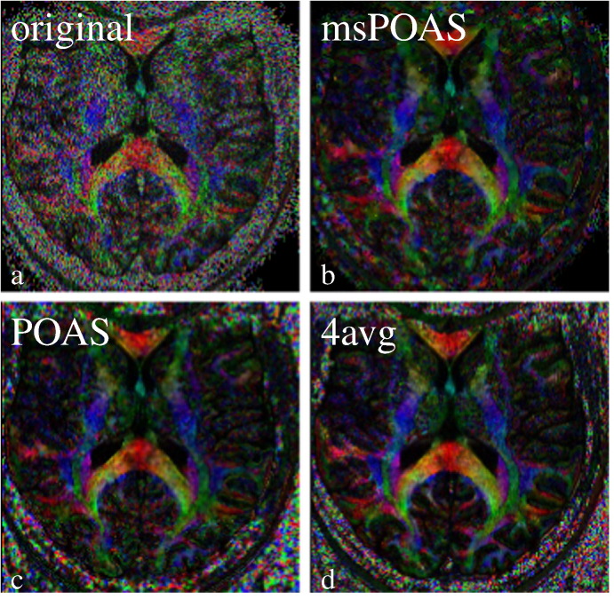 Fig. 4