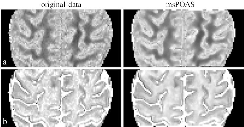 Fig. 11