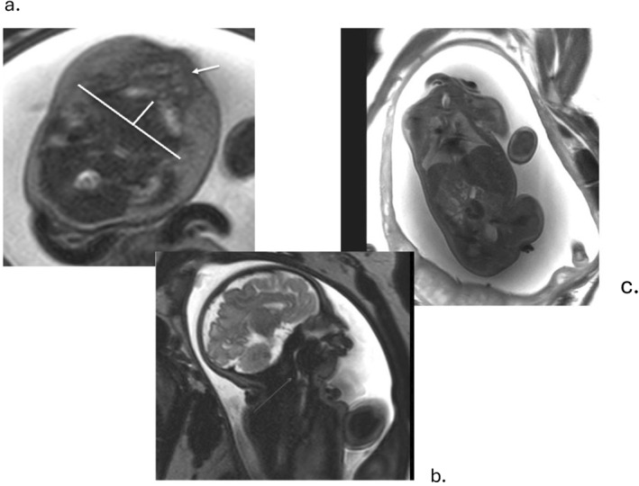 FIGURE 3