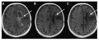 Fig. (3)