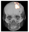 Fig. (2)