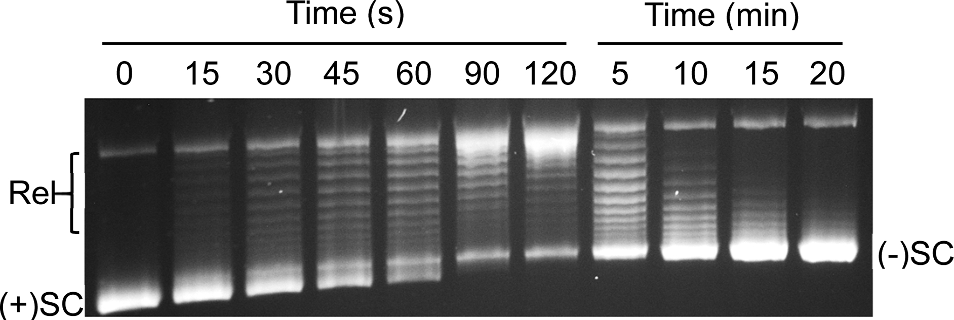 Two-Dimensional Gel Electrophoresis to Resolve DNA Topoisomers - PMC