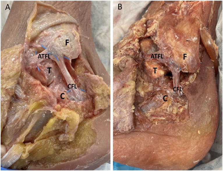 Figure 2.