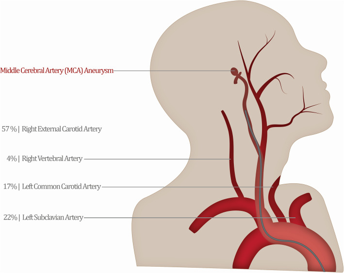 Fig. 4