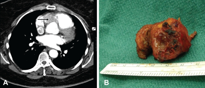 Figure 1)