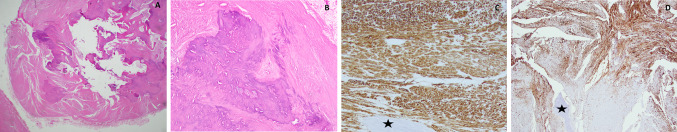 Fig. 2
