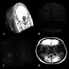 FIG. 15.