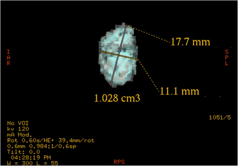 Fig. 2