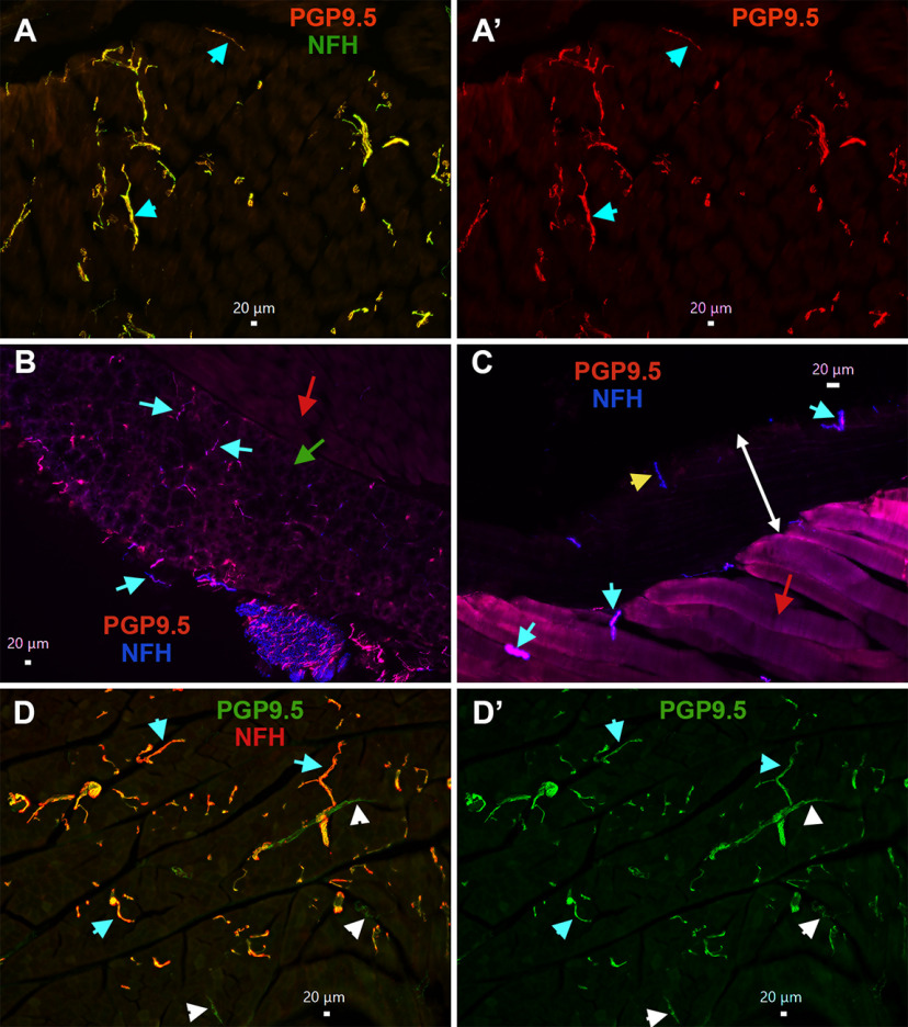 Figure 11.