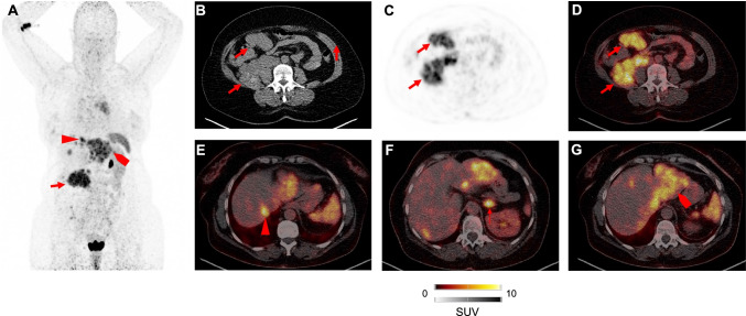 Fig. 2