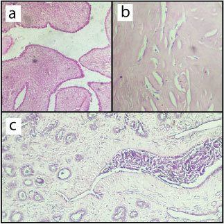 [Table/Fig-4]: