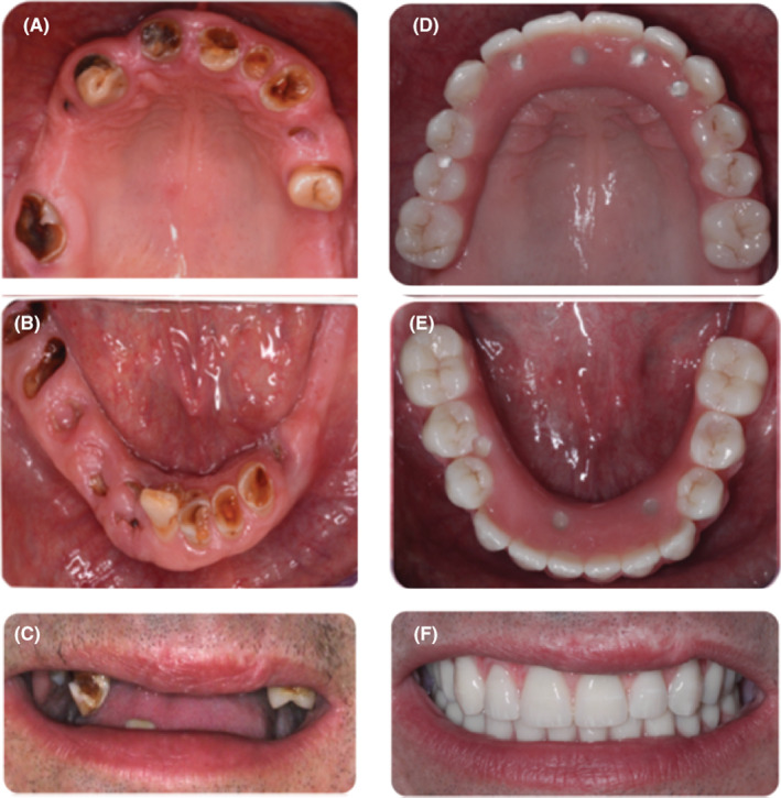 FIGURE 4