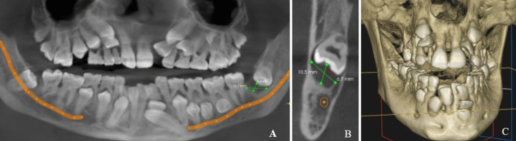 Figure 5