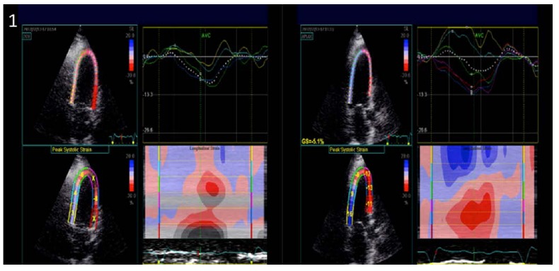 Fig. (1)