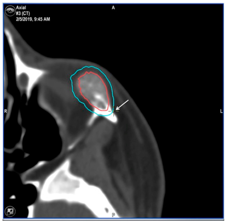 Figure 15