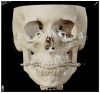 Figure 17