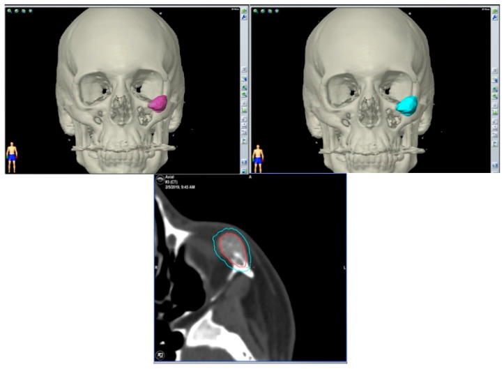 Figure 12