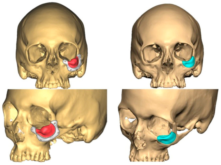 Figure 13