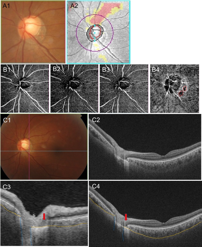 Figure 3